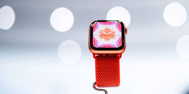 Apple Watch dominiert Smartwatch-Markt