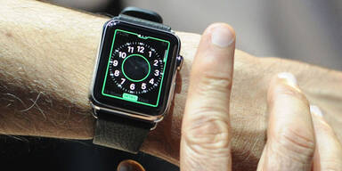 Apple Watch ist ab sofort besser