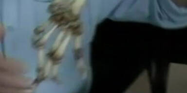 Arzt reist mit fremden Arm im Gep&auml;ck