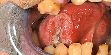 Schock-Packungen kommen ab 20. Mai