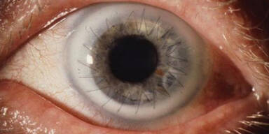 auge