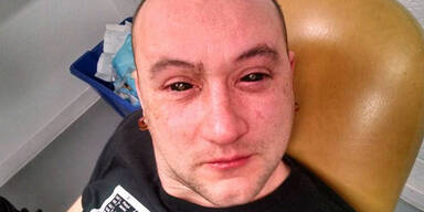 Augen-Hacking: Mann sieht bei Nacht