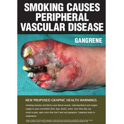 Zigarettenpackerl in Australien