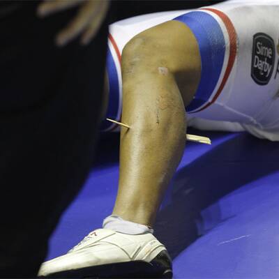 20-cm-Holzsplitter durchbohr Radler-Bein