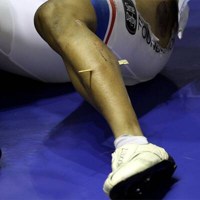 20-cm-Holzsplitter durchbohr Radler-Bein