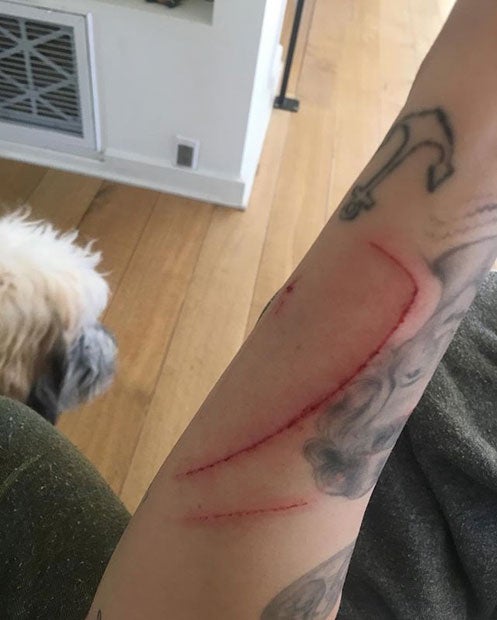 Miley Cyrus: Von der Katze zerkratzt