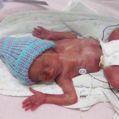 Fünflinge in den USA geboren