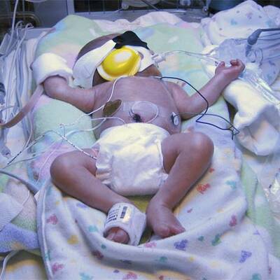 Fünflinge in den USA geboren