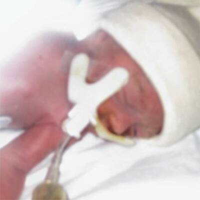 Fünflinge in den USA geboren