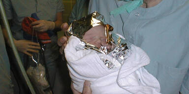 Baby Herz-OP Salzburg