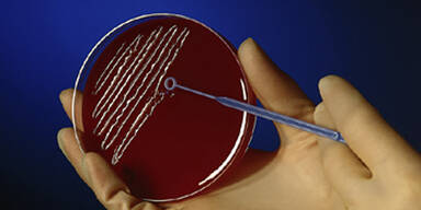 bakterien petrischale