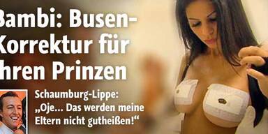 Busen-OP: Bambi zieht blank im TV