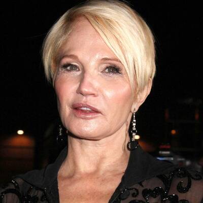 Wer hat Hollywoods schlimmste OP-Fratze?