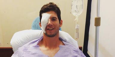 Baseball-Star verliert Auge beim Stretching