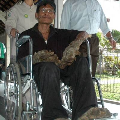 Das ist der Baum-Mann