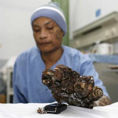 Die ersten Bilder nach der OP