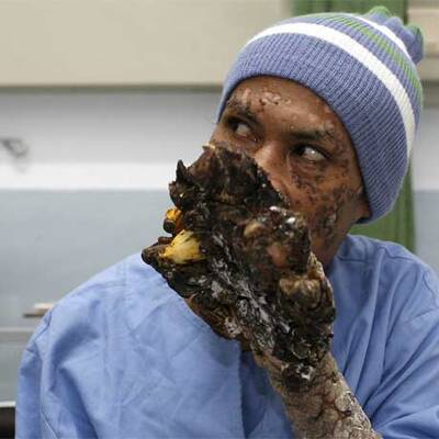 Die ersten Bilder nach der OP