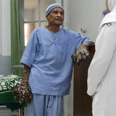 Die ersten Bilder nach der OP