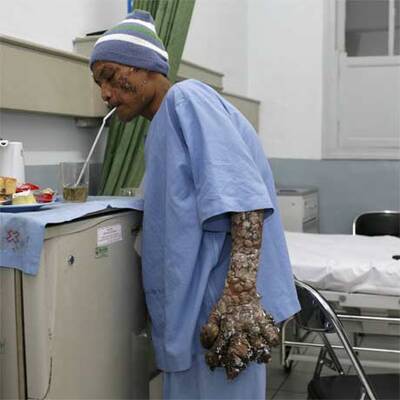 Die ersten Bilder nach der OP