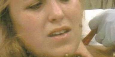 Ast durchbohrte Hals einer 20-Jährigen