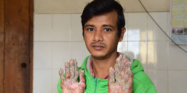 Baummann Abul Bajandar