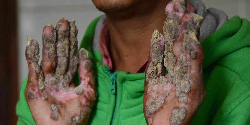 Baummann Abul Bajandar