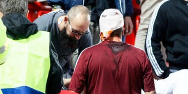 Brutale Hooligan-Attacke auf Bayern-Fans