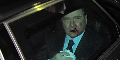 Berlusconi kann kaum etwas essen