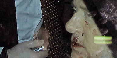 Berlusconi kann kaum etwas essen