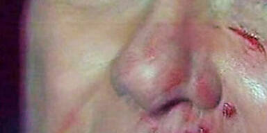 Berlusconi kann kaum etwas essen