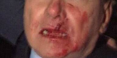 Berlusconi mit verbundenem Gesicht heim