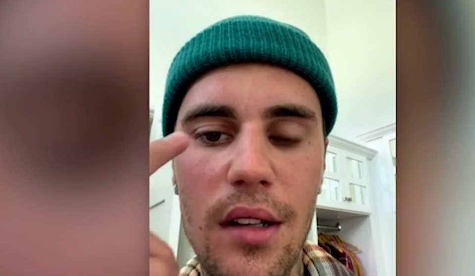 Justin Bieber schockiert Fans: Welttournee abgesagt