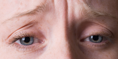 Botox gegen Migräne