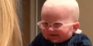 Baby Albino
