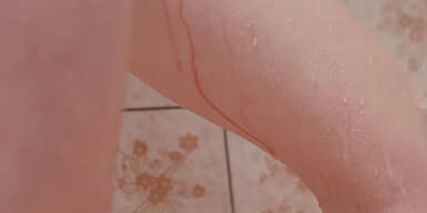 Shitstorm wegen Menstruations-Blut in Werbung