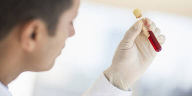 Teenager entwickelt neuen Krebstest