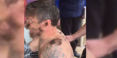 Fies: Bei Bachelor- Party Schamhaare ins Gesicht geklebt!