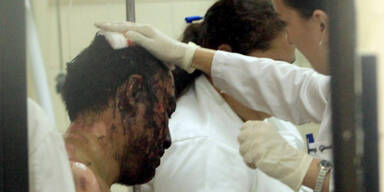 30 Tote bei Machtkampf im Knast