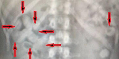 Drogen-Kurier hatte 1 Kilo Koks im Bauch