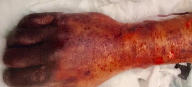 Hund leckt Herrchen übers Gesicht – Mann tot