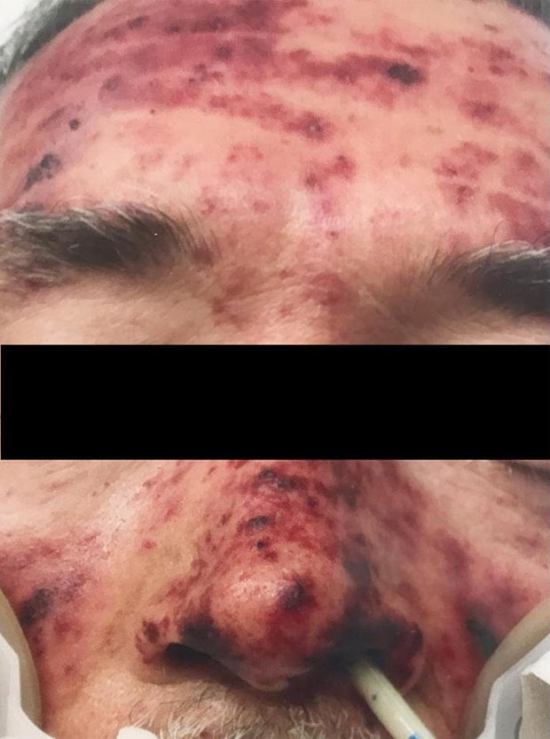 Hund leckt Herrchen übers Gesicht – Mann tot