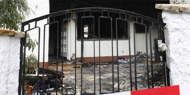 Bayern-Spieler bei Brand verletzt