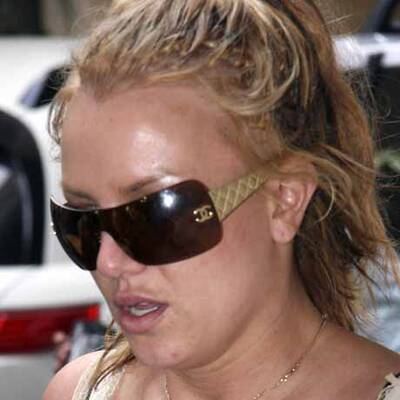 Die Stars mit der schlechtesten Haut