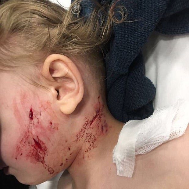 Horror-Video: Pitbull zerfetzt kleinen Buben