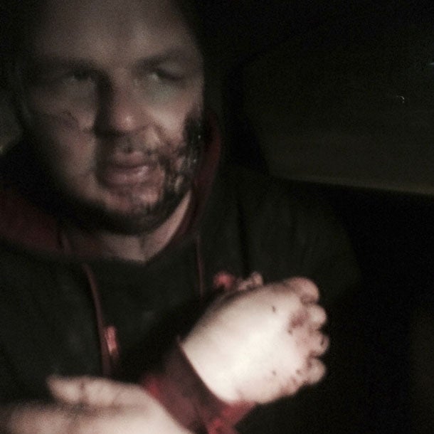 Hausarrest für gefolterten Aktivisten