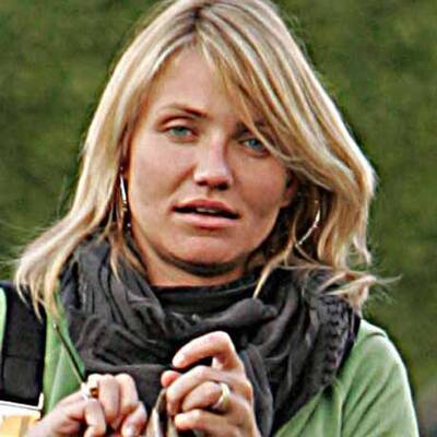 Die Stars mit der schlechtesten Haut