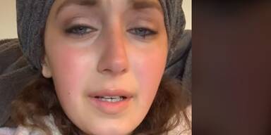 TikTok-Star starb an Hautkrebs