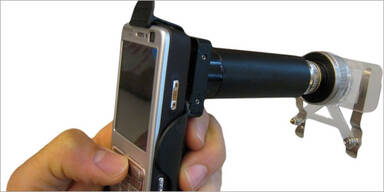 Handy-Mikroskop unter Finalisten