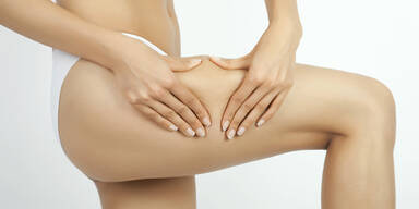 Cellulite Haut