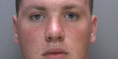 Student hackt sich im Rausch Penis ab